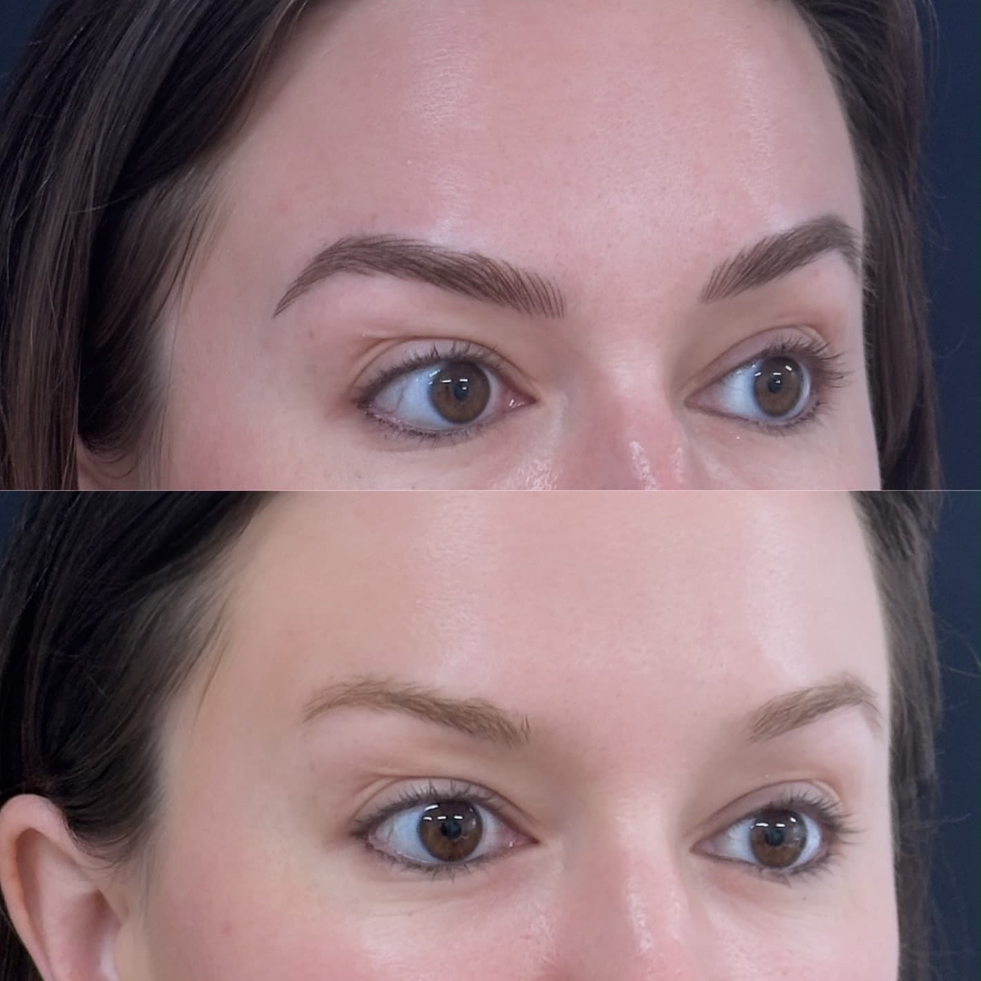Front-facing before and after custom brow result